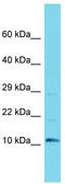 Uncharacterized protein C9orf170 antibody, TA334913, Origene, Western Blot image 