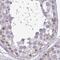 Ribosomal L24 Domain Containing 1 antibody, PA5-64114, Invitrogen Antibodies, Immunohistochemistry paraffin image 
