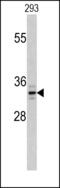 Palmitoyl-Protein Thioesterase 1 antibody, MBS9206847, MyBioSource, Western Blot image 