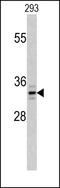 Palmitoyl-Protein Thioesterase 1 antibody, MBS9206847, MyBioSource, Western Blot image 