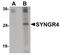 Synaptogyrin 4 antibody, PA5-20879, Invitrogen Antibodies, Western Blot image 