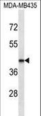 LIM Homeobox 2 antibody, LS-C165763, Lifespan Biosciences, Western Blot image 