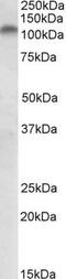 Polo Like Kinase 4 antibody, NB100-894, Novus Biologicals, Western Blot image 