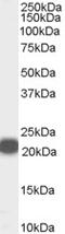 Sirtuin 1 antibody, 43-119, ProSci, Western Blot image 