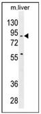 Spire Type Actin Nucleation Factor 2 antibody, AP54024PU-N, Origene, Western Blot image 