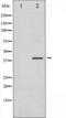 Eukaryotic Translation Initiation Factor 2 Subunit Alpha antibody, TA325445, Origene, Western Blot image 