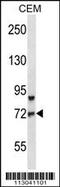 Forkhead Box O3 antibody, MBS9203666, MyBioSource, Western Blot image 