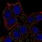 Activator Of Basal Transcription 1 antibody, NBP2-69030, Novus Biologicals, Immunocytochemistry image 