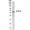 CUGBP Elav-Like Family Member 2 antibody, GTX70345, GeneTex, Western Blot image 