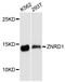 Zinc Ribbon Domain Containing 1 antibody, LS-C748149, Lifespan Biosciences, Western Blot image 