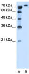 Solute Carrier Family 6 Member 18 antibody, TA334626, Origene, Western Blot image 