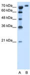 Solute Carrier Family 6 Member 18 antibody, TA334626, Origene, Western Blot image 