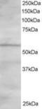 Oxysterol Binding Protein Like 2 antibody, MBS420292, MyBioSource, Western Blot image 