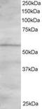 Oxysterol Binding Protein Like 2 antibody, MBS420292, MyBioSource, Western Blot image 