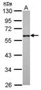 Cell Division Cycle 25C antibody, GTX102809, GeneTex, Western Blot image 