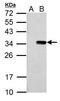 T7 epitope tag antibody, GTX128059, GeneTex, Western Blot image 