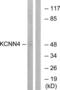 Ik1 antibody, LS-C199160, Lifespan Biosciences, Western Blot image 