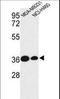 Tafazzin antibody, LS-C161720, Lifespan Biosciences, Western Blot image 