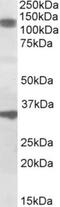 Cell Division Cycle And Apoptosis Regulator 1 antibody, NBP1-46158, Novus Biologicals, Western Blot image 