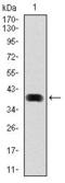 Microtubule Associated Protein 1 Light Chain 3 Beta antibody, GTX60594, GeneTex, Western Blot image 