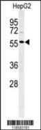 DNA Polymerase Lambda antibody, 64-197, ProSci, Western Blot image 