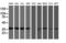 O-Sialoglycoprotein Endopeptidase antibody, M13000-1, Boster Biological Technology, Western Blot image 