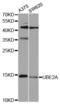 Ubiquitin Conjugating Enzyme E2 A antibody, STJ110055, St John