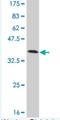 TXK Tyrosine Kinase antibody, H00007294-M02, Novus Biologicals, Western Blot image 