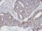 Actin Related Protein 2/3 Complex Subunit 3 antibody, PA5-21404, Invitrogen Antibodies, Immunohistochemistry frozen image 