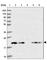 Transmembrane P24 Trafficking Protein 10 antibody, HPA047139, Atlas Antibodies, Western Blot image 