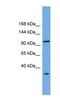 Chromosome Transmission Fidelity Factor 18 antibody, NBP1-57605, Novus Biologicals, Western Blot image 