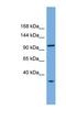 Chromosome transmission fidelity protein 18 homolog antibody, NBP1-57605, Novus Biologicals, Western Blot image 