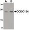 Coiled-Coil Domain Containing 134 antibody, PA5-20780, Invitrogen Antibodies, Western Blot image 