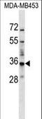 Basic Leucine Zipper ATF-Like Transcription Factor 2 antibody, LS-C159162, Lifespan Biosciences, Western Blot image 