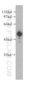 Glycogen Synthase Kinase 3 Alpha antibody, 13419-1-AP, Proteintech Group, Western Blot image 