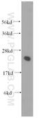 Ubiquitin Conjugating Enzyme E2 K antibody, 11834-3-AP, Proteintech Group, Western Blot image 
