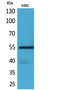 CD55 Molecule (Cromer Blood Group) antibody, STJ96615, St John