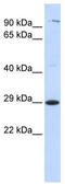 Tetraspanin 2 antibody, TA339024, Origene, Western Blot image 