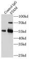 Signal Transducing Adaptor Molecule antibody, FNab08283, FineTest, Immunoprecipitation image 
