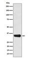 Methyl-CpG Binding Domain Protein 3 antibody, M02571-3, Boster Biological Technology, Western Blot image 
