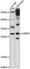CCAAT Enhancer Binding Protein Delta antibody, LS-C750230, Lifespan Biosciences, Western Blot image 