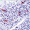 CD1a Molecule antibody, LS-C87886, Lifespan Biosciences, Immunohistochemistry paraffin image 