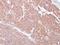c-Kit antibody, M01335, Boster Biological Technology, Immunohistochemistry paraffin image 