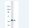Integrin Subunit Beta 5 antibody, H00003693-M02, Novus Biologicals, Western Blot image 