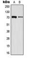 Matrix Metallopeptidase 16 antibody, LS-C354032, Lifespan Biosciences, Western Blot image 