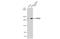 Lysine Demethylase 3B antibody, GTX116198, GeneTex, Western Blot image 