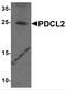 Phosducin Like 2 antibody, 7887, ProSci, Western Blot image 