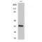 Cyclin Dependent Kinase 2 antibody, LS-C382659, Lifespan Biosciences, Western Blot image 