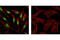 Cyclin Dependent Kinase Inhibitor 1C antibody, 2558S, Cell Signaling Technology, Immunofluorescence image 