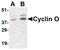 Cyclin O antibody, PA5-20263, Invitrogen Antibodies, Western Blot image 